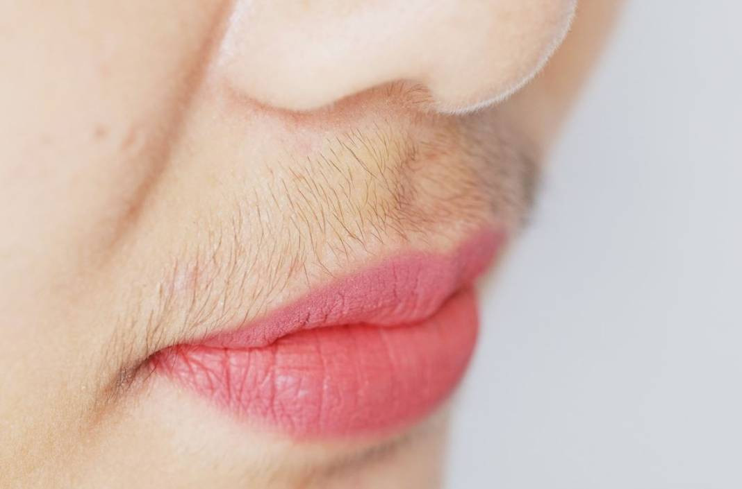 Ağda, ip ve cımbızı unutun! Bir kaşıkla tüyleri yok edin - Resim: 30